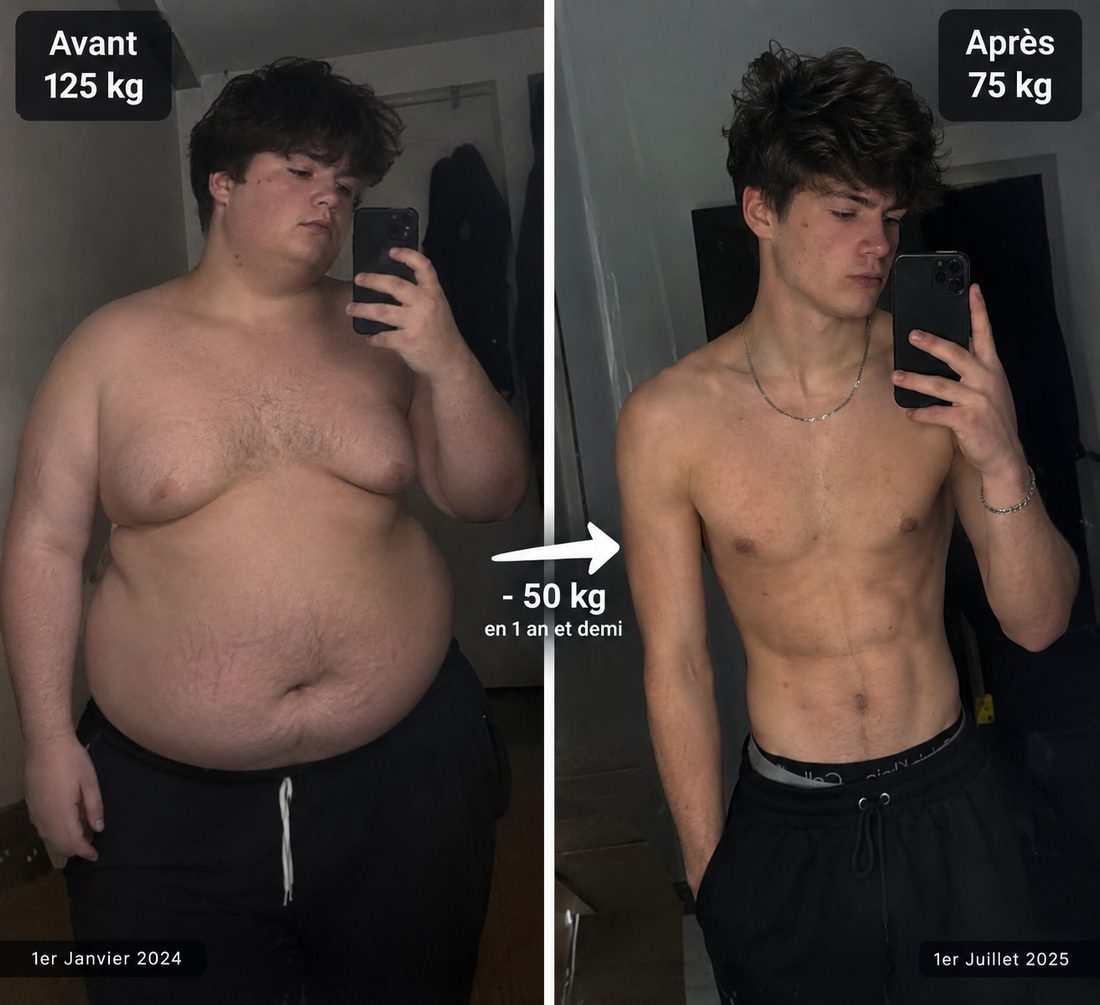Photos avant et après d’un membre : 125 kg puis 75 kg